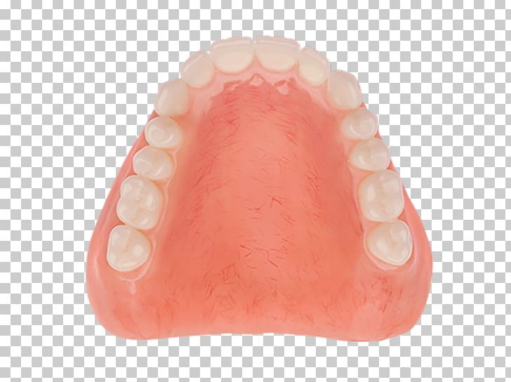 Dentures Tooth Dentistry Acrylic Resin Poly PNG, Clipart, Acrylic Resin, Aspen, Aspen Dental, Custom, Dentistry Free PNG Download
