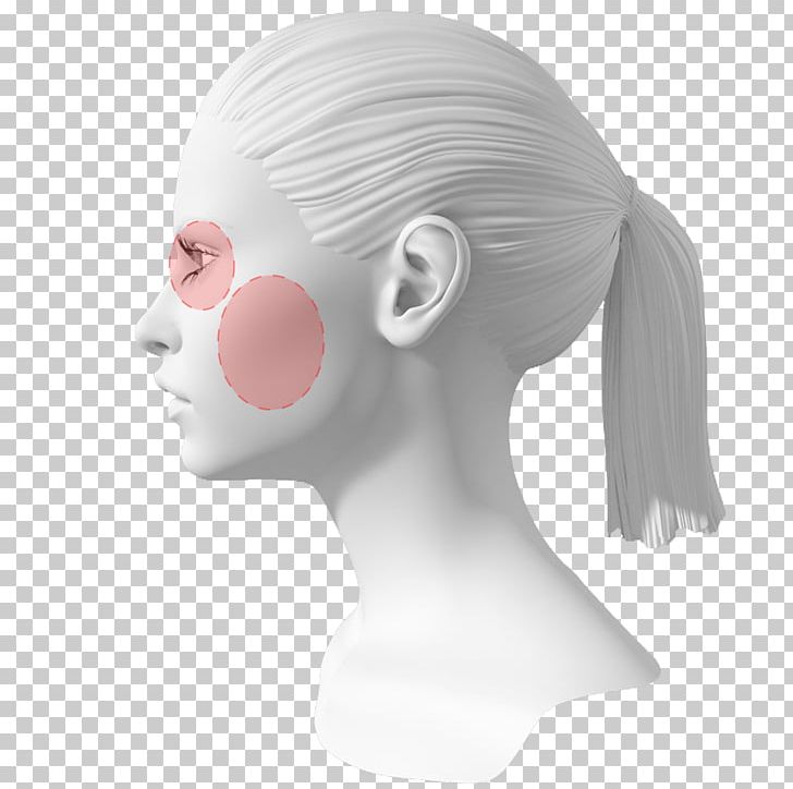 Perioral Dermatitis Acne Cosmetics Chin PNG, Clipart, Acne, Chin, Cosmetics, Dermatitis, Ear Free PNG Download