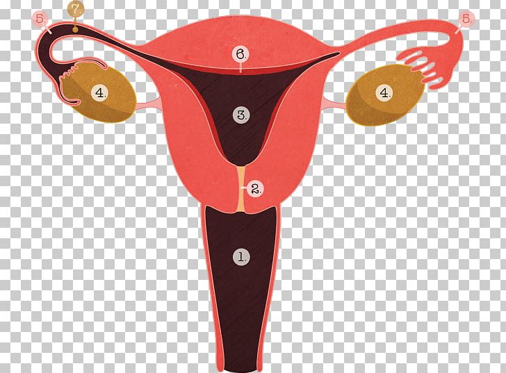 Tubal Ligation Ligature Menstruation Adenomyosis Reproductive System PNG, Clipart, Adenomyosis, Birth Control, Endometriosis, Fashion Accessory, Intrauterine Device Free PNG Download