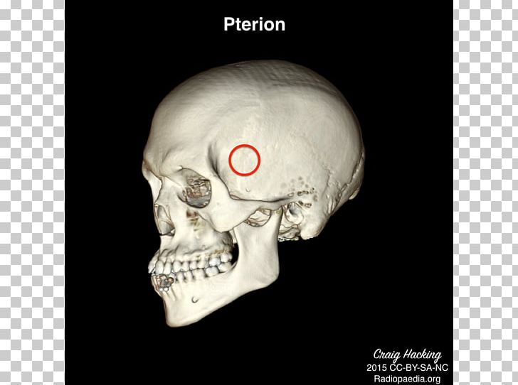 Anatomy Physical Therapy Skull Health PNG, Clipart, Anatomy, Bone, Bulletin Board, Fantasy, Fler Free PNG Download