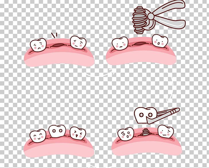 Drawing Tooth Dental Implant PNG, Clipart, Animaatio, Body Jewelry, Cartoon, Dental Arch, Dental Implant Free PNG Download