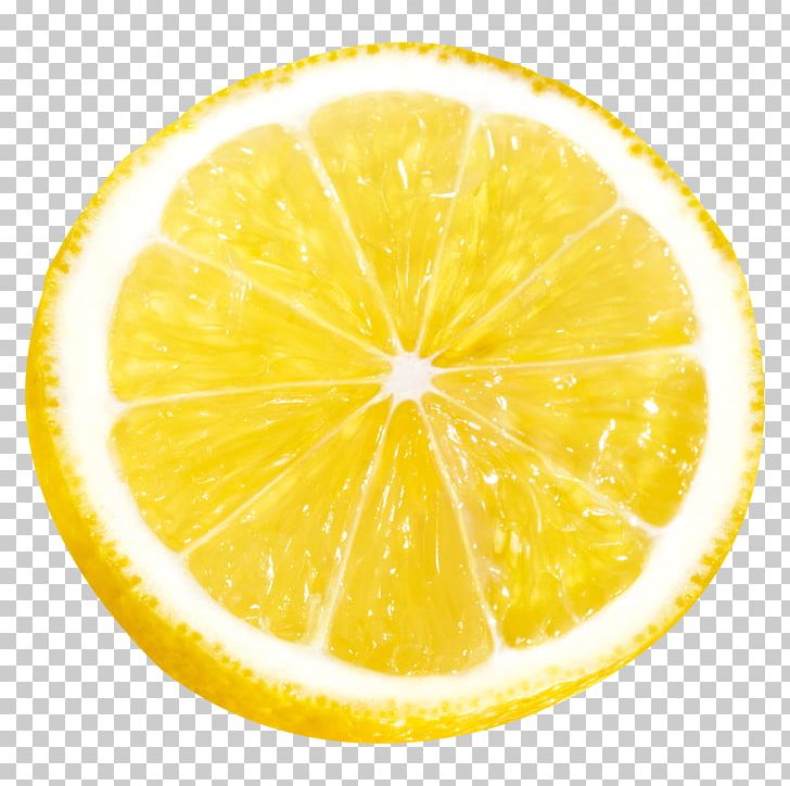 Lemon Juice Yellow PNG, Clipart, Circle, Citric Acid, Citron, Citrus, Color Free PNG Download