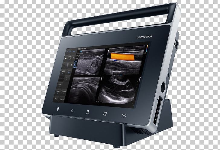 Ultrasonography Samsung Electronics Ultrasound Medicine PNG, Clipart, Contrast Resolution, Dis, Electronics, Imaging Technology, Logos Free PNG Download