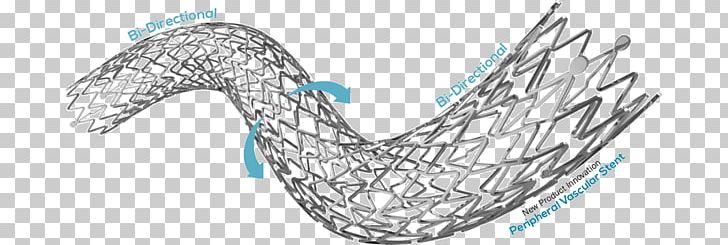 Stenting Coronary Stent Self-expandable Metallic Stent Nickel Titanium Peripheral Artery Disease PNG, Clipart, Angiology, Angioplasty, Angle, Body Jewelry, Catheter Free PNG Download
