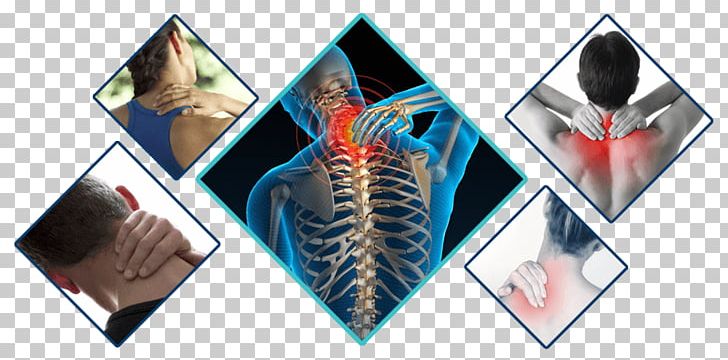 Neck Pain Human Back Chiropractic Hip Pain Back Pain PNG, Clipart, Ache, Back Pain, Chiropractic, Chiropractor, Clinic Free PNG Download