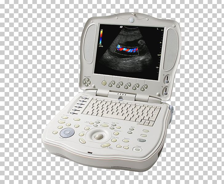 Medical Equipment Ultrasonography Portable Ultrasound GE Healthcare SonoSite PNG, Clipart, Electronic Device, Electronics, Gadget, Ge Healthcare, General Electric Free PNG Download