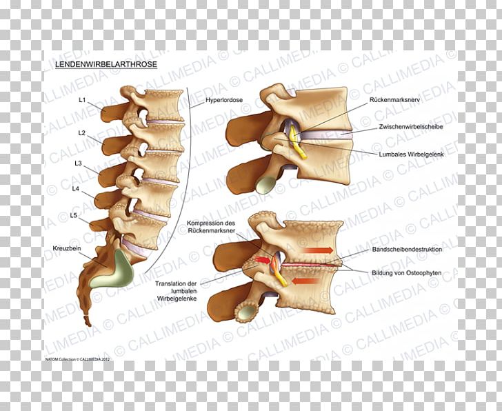 Joint Osteoarthritis Lumbar Vertebrae Process Human Back PNG, Clipart, Anatomy, Cervical Vertebrae, Human Anatomy, Human Back, Joint Free PNG Download
