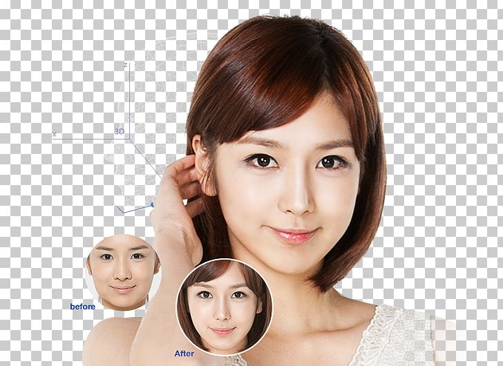 Plastic Surgery Ho Chi Minh City Nose Face Chin PNG, Clipart, Beauty, Bone, Brown Hair, Business, Cheek Free PNG Download