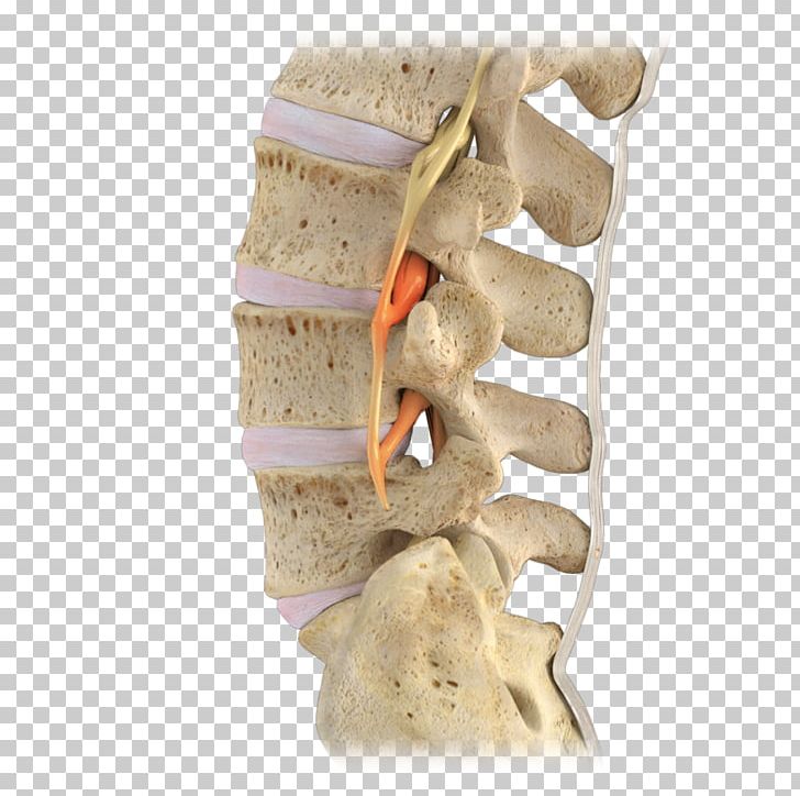 Lumbar Vertebrae Vertebral Column Spinal Stenosis Spinal Nerve PNG, Clipart, Cervical Vertebrae, Human Back, Lumbar, Lumbar Spinal Stenosis, Lumbar Vertebrae Free PNG Download