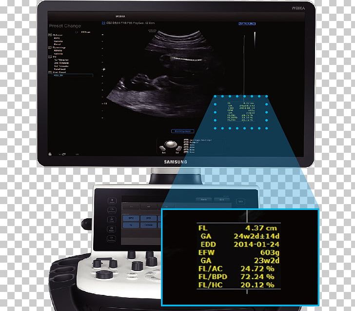 Ultrasound Ultrasonography Samsung Medison Samsung Electronics PNG, Clipart, Business, Consumer, Display Device, Electronics, Electronics Accessory Free PNG Download