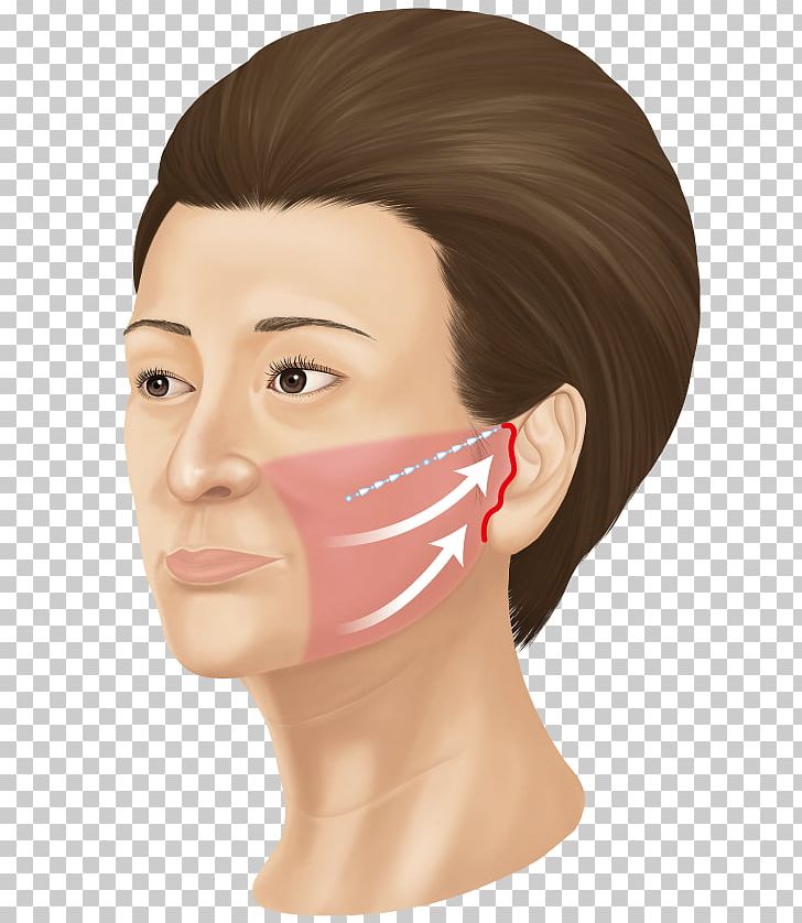 Cheek サフォクリニック Forehead Face フェイスリフト PNG, Clipart, Brown Hair, Cheek, Chin, Ear, Eyebrow Free PNG Download