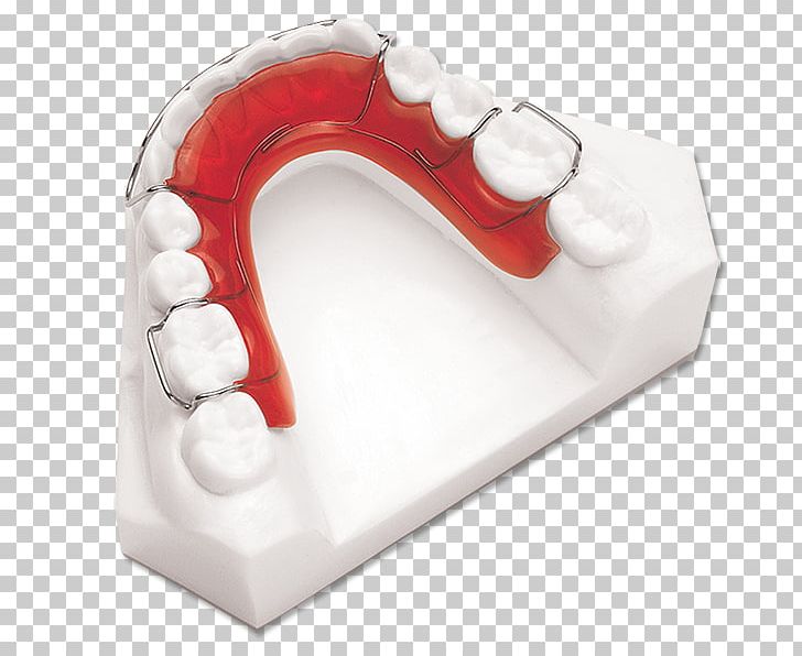 Retainer Jaw Orthodontics Mandible Tooth PNG, Clipart, Adviser, Cost, Fee, Investopedia, Jaw Free PNG Download
