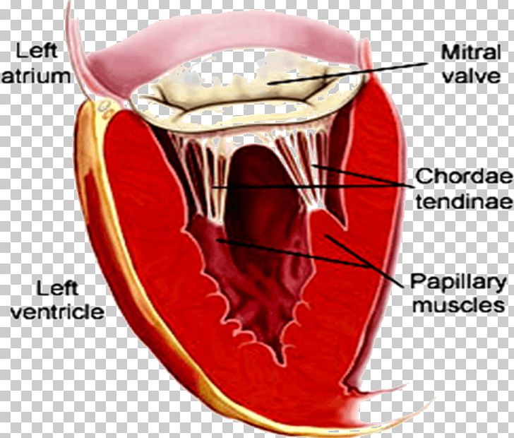 Mitral Valve Stenosis Heart Valve Mitral Insufficiency PNG, Clipart, Atrium, Blood, Blood Vessel, Heart, Heart Sounds Free PNG Download
