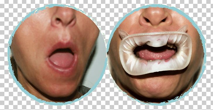 Nose Chin Cheek Jaw Mouth PNG, Clipart, Cheek, Chin, Closeup, Closeup, Face Free PNG Download