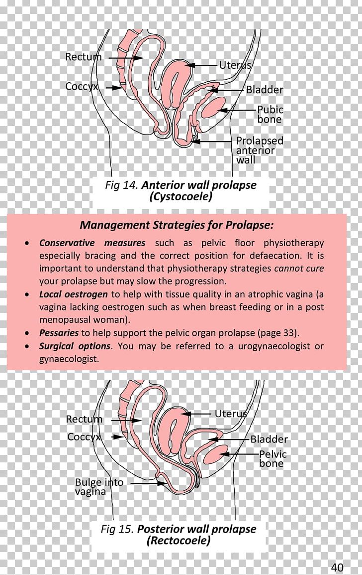 Surgery Book Pelvic Floor Gynaecology Physical Therapy PNG, Clipart, Angle, Area, Arm, Book, Diagram Free PNG Download