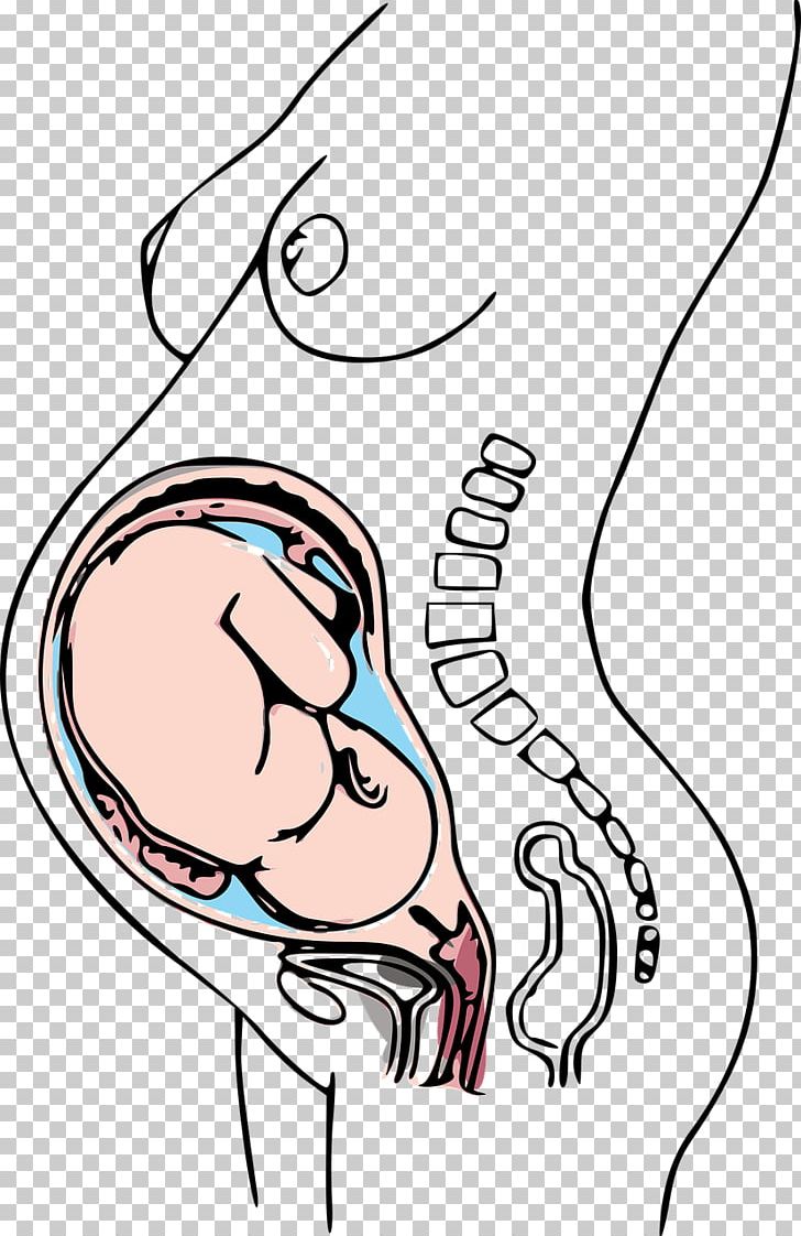 Pregnancy Caesarean Section Prenatal Care Morning Sickness Woman PNG, Clipart, Arm, Cheek, Child, Clo, Disease Free PNG Download