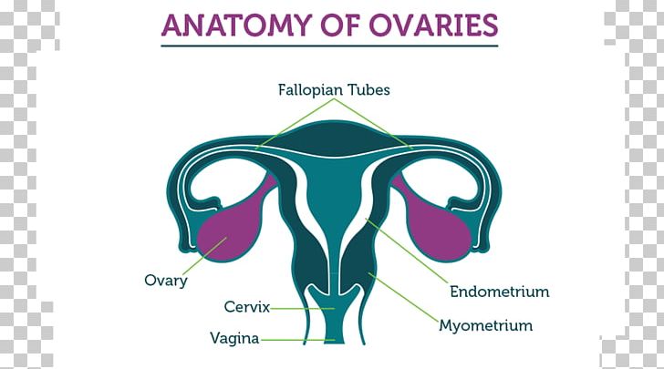 Ovarian Cancer Ovary Fallopian Tube Ovarian Tumor PNG, Clipart, Audio, Brand, Cancer, Cell, Ear Free PNG Download