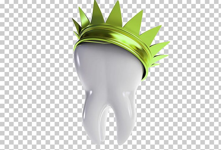 Crown Dentistry Bridge Dental Restoration Dentures PNG, Clipart, 3d Arrows, Bar Chart, Bleeding, Cartoon, Computer Wallpaper Free PNG Download