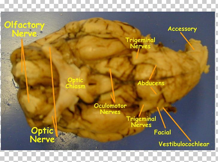 Sheep Cranial Nerves Brain Hypoglossal Nerve Olfactory Nerve PNG, Clipart, Abducens Nerve, Anatomy, Animals, Brain, Cranial Nerves Free PNG Download