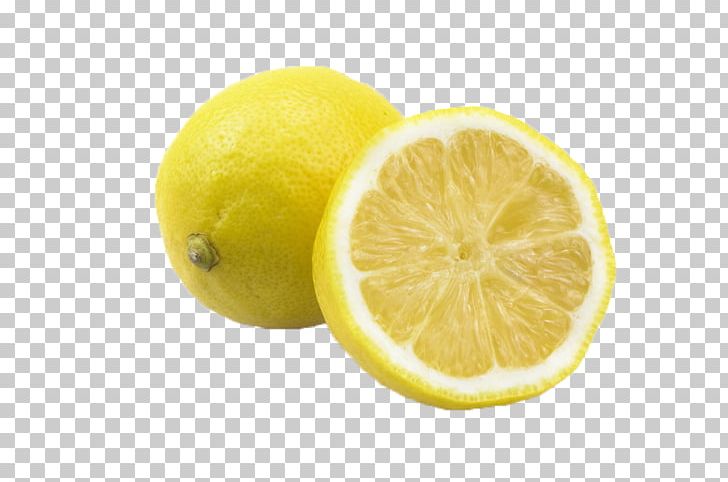 Lemon-lime Drink PNG, Clipart, Citric Acid, Citron, Citrus, Citrus Junos, Download Free PNG Download