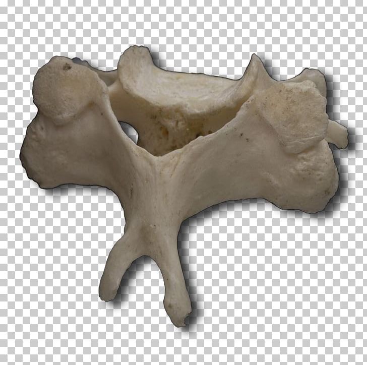 Human Vertebral Column Atlas Cervical Vertebrae PNG, Clipart, Anatomy, Articular Processes, Artifact, Atlas, Bone Free PNG Download