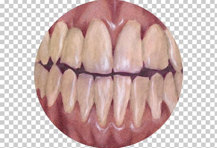 Human Tooth Homo Sapiens Sycra PNG, Clipart, Borderlands, Cartoon, Crooked, Drawing, Game Free PNG Download