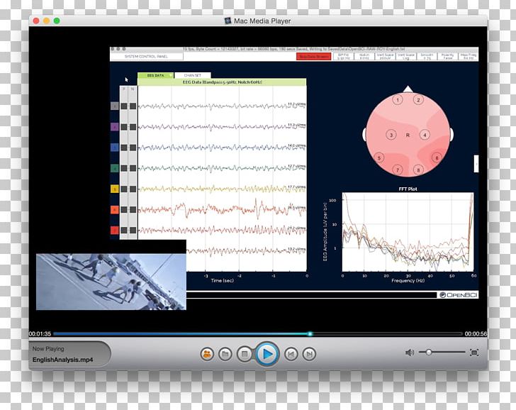 Computer Program Electroencephalography OpenBCI Computer Monitors PNG, Clipart,  Free PNG Download