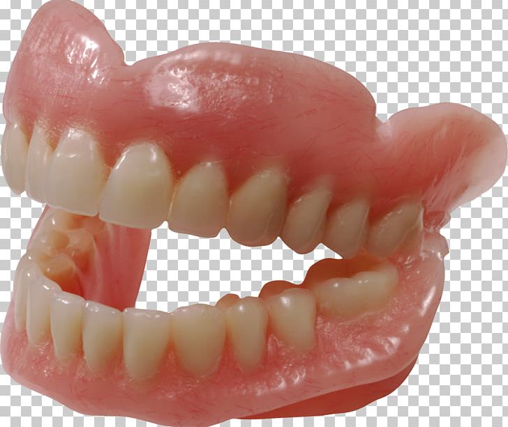 Dentistry Dentures PNG, Clipart, Dentist, Dentistry, Dentures, Gums, Health Beauty Free PNG Download