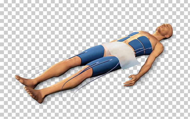 Arctic Sun Medical Device Targeted Temperature Management Patient Hypothermia PNG, Clipart, Abdomen, Arm, Hospital, Human Body, Mat Free PNG Download