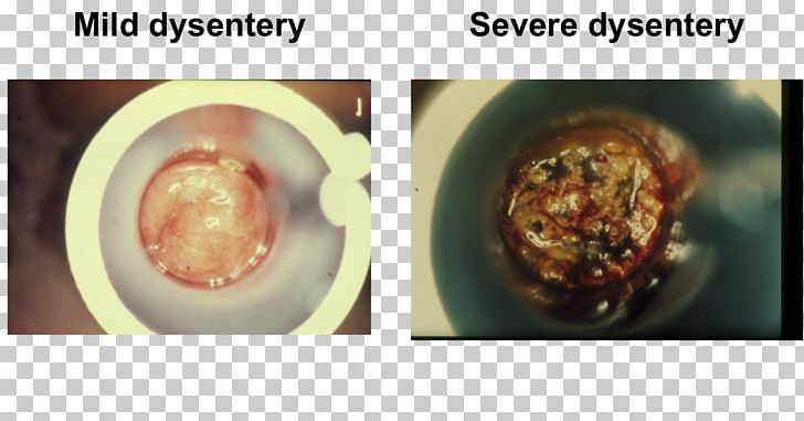 blood stool test at home