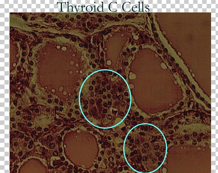 Parafollicular Cell Thyroid Endocrine System PNG, Clipart, Biology, Brown, Cell, Circle, Endocrine Gland Free PNG Download