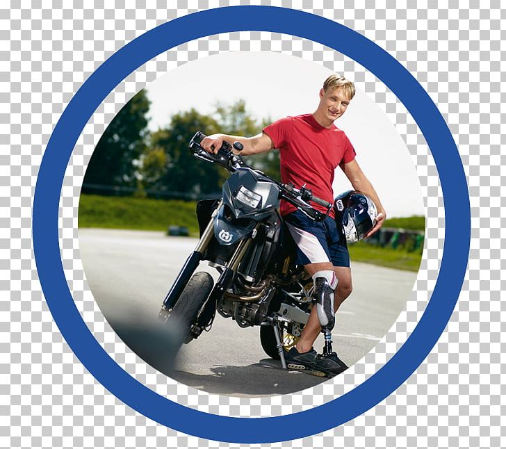 Prosthesis Oberschenkelprothese Bicycle Price Motorcycle PNG, Clipart, Bicycle, Bicycle Accessory, Catalog, Crazy Referee Pro, Dental Implant Free PNG Download