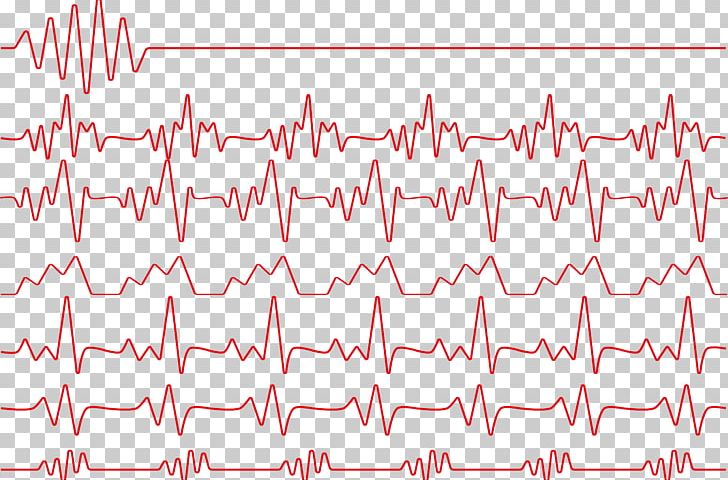 Red Heart Rate Electrocardiography Monitoring PNG, Clipart, Angle, Decorative Patterns, Design, Ecg Monitor, Electrocardiogram Free PNG Download