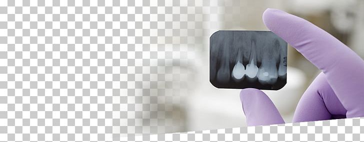 Dentistry Tooth ArseDent Therapy PNG, Clipart, Anesthesia, Brush, Clinic, Closeup, Cosmetics Free PNG Download