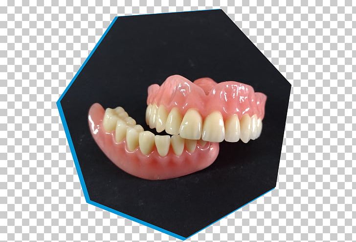 Brembio Dental Laboratory Dentures Tooth Sant'Angelo Lodigiano PNG, Clipart,  Free PNG Download