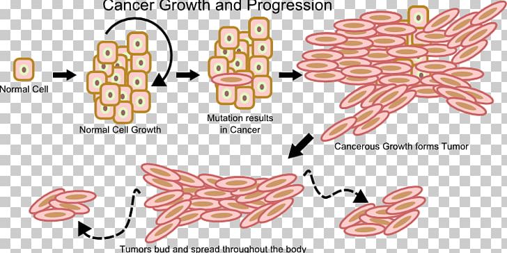 Cancer Cell Cell Growth Neoplasm PNG, Clipart, Angle, Apoptosis, Area, Art, Cancer Free PNG Download