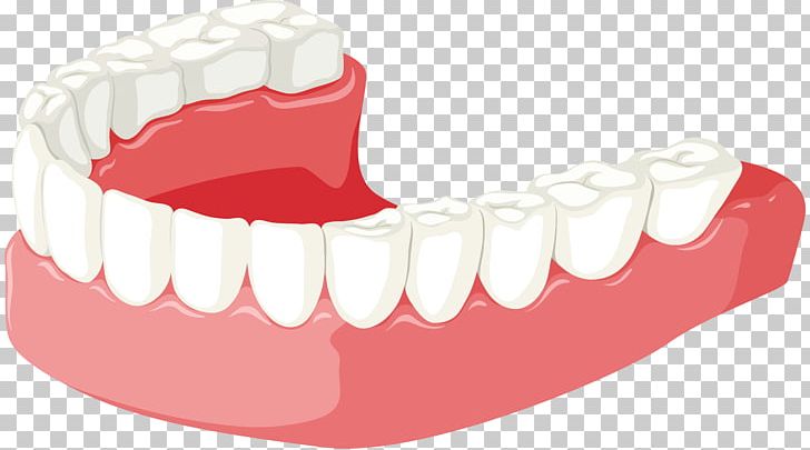 Tooth Jaw Dentures PNG, Clipart, Cartoon, Clip Art, Dent, Dentures, Drawing Free PNG Download