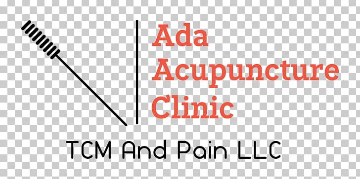 Acupuncture Migraine Headache Back Pain Chronic Pain PNG, Clipart, Ache, Acupuncture, Akupunktiopiste, Angle, Area Free PNG Download
