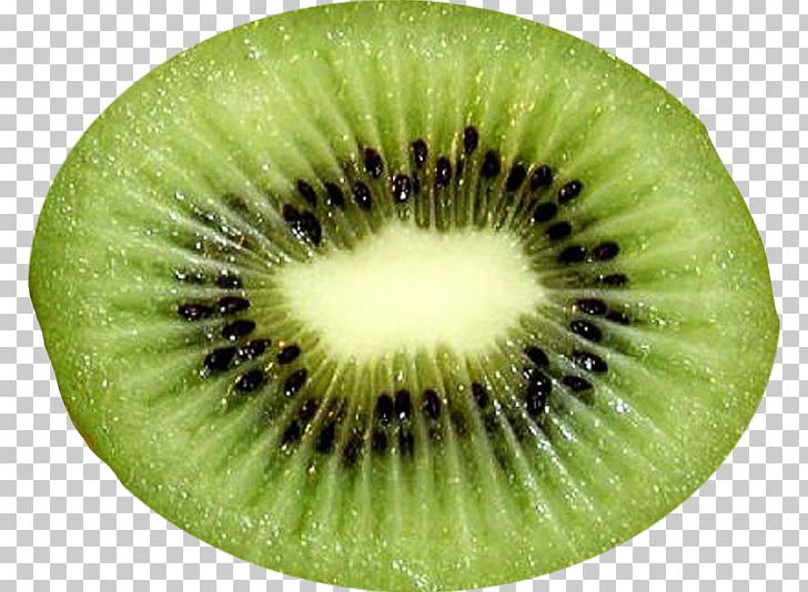 Kiwifruit Frutti Di Bosco Hardy Kiwi Food PNG, Clipart, Actinidain, Apple, Cartoon Kiwi, Dried Fruit, Food Free PNG Download