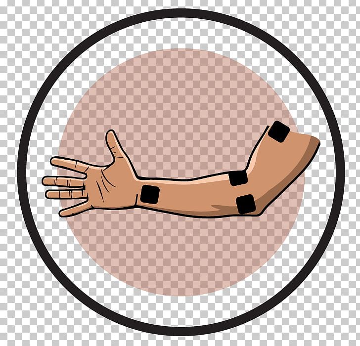 Thumb Transcutaneous Electrical Nerve Stimulation Electrical Muscle Stimulation Electrode Pain PNG, Clipart, Arm, Elbow, Electrical Muscle Stimulation, Electrode, Electrotherapy Free PNG Download