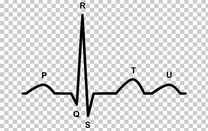 Electrocardiography Heart Arrhythmia Cardiology Cardiovascular Disease PNG, Clipart, American Heart Association, Angle, Area, Atrium, Black Free PNG Download