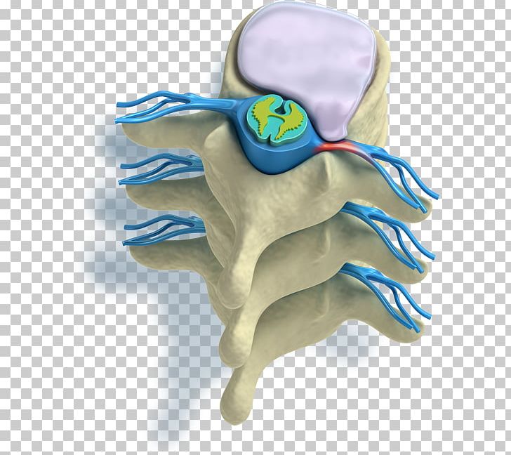 Pain In Spine Vertebral Column Spinal Disc Herniation Radicular Pain Intervertebral Disc PNG, Clipart, Chiropractic, Electric Blue, Finger, Hand, Human Back Free PNG Download