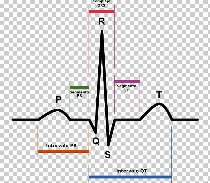 Electrocardiography Qrs Complex Sinus Rhythm Heart T Wave Png Clipart Angle Area Cardiac Muscle Cardiology Diagram