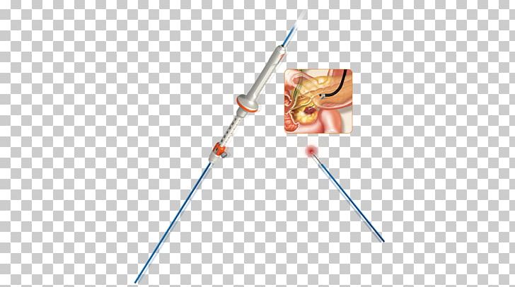 Line Angle PNG, Clipart, Angle, Art, Endoscopy, Line Free PNG Download