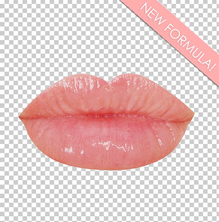 Lip Gloss Lip Balm Lipstick Glitter PNG, Clipart, Computer Icons, Glitter, Gold Chandelier, Lip, Lip Balm Free PNG Download