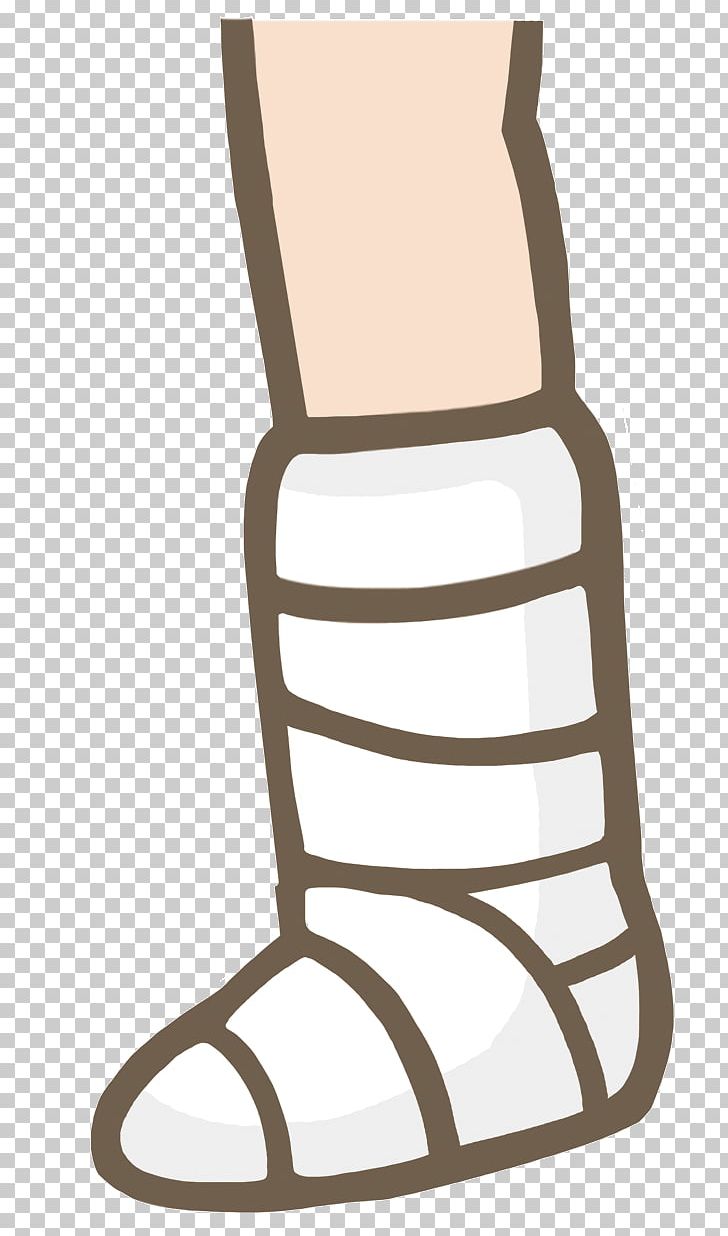 Orthopedic Cast Strain Bandage Crutch Foot PNG, Clipart, Arm, Bandage, Bone Fracture, Chair, Crutch Free PNG Download