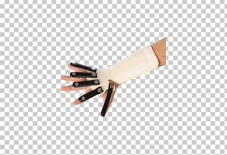 Thumb Radial Nerve Hand Radial Artery Forearm PNG, Clipart, Alime, Alimed Inc, Com, Digit, Finger Free PNG Download