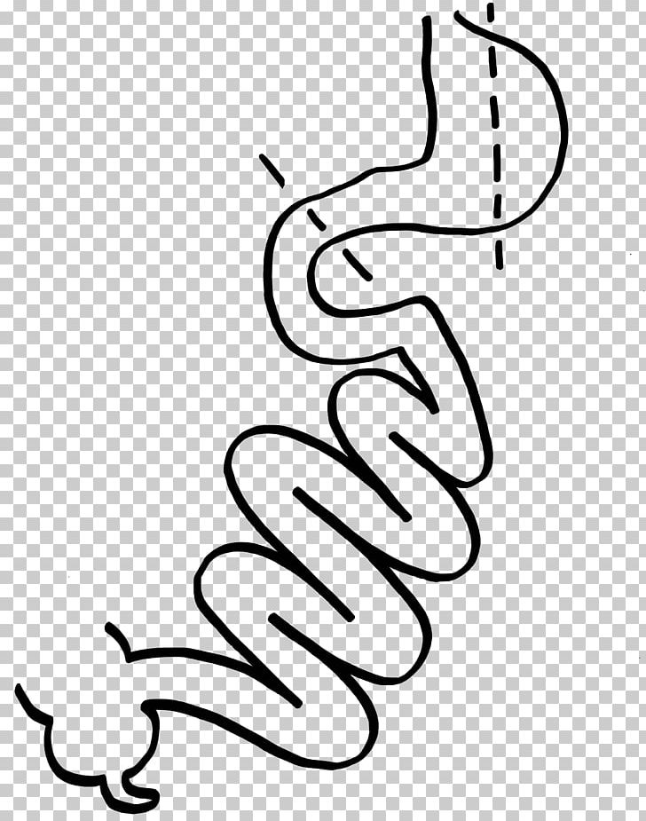 SADI-S Surgery Duodenal Switch Gastric Bypass Surgery Duodenum PNG, Clipart, Anastomosis, Area, Art, Artwork, Black Free PNG Download