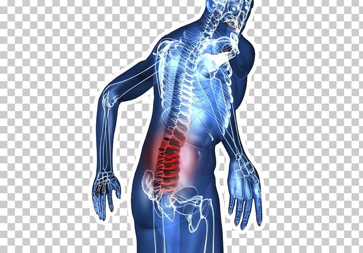 Low Back Pain Neck Pain Back Injury Human Back PNG, Clipart, Abdomen, Ache, Arm, Back, Back Pain Free PNG Download