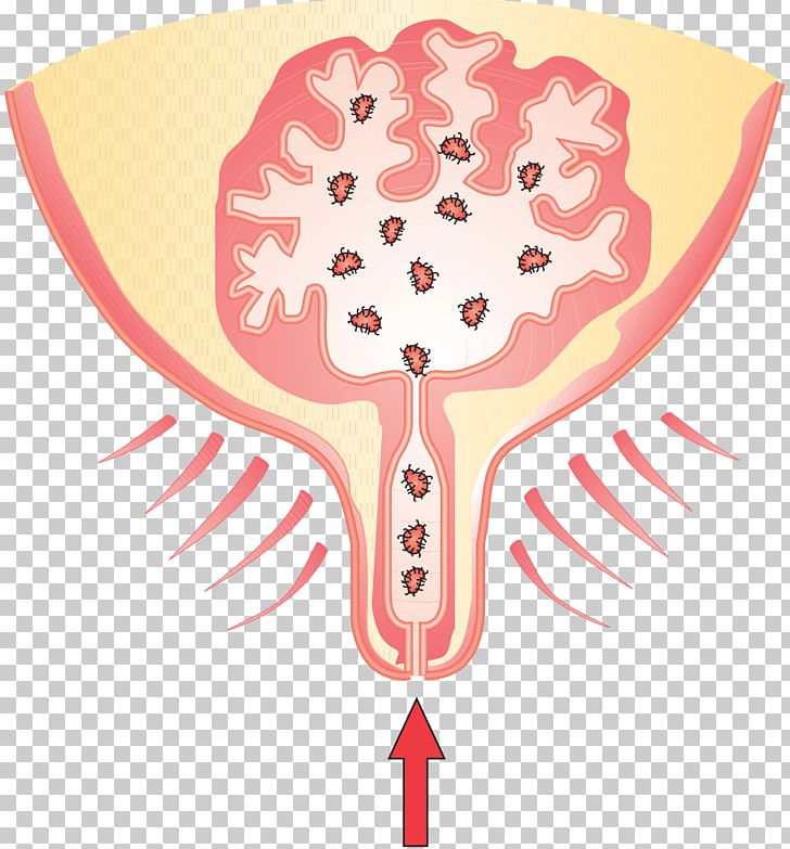Cattle Milk Mammary Gland Mastitis Bacteria PNG, Clipart, Art, Bacteria, Cartoon, Cattle, Cell Free PNG Download